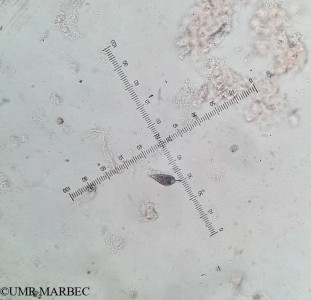 phyto/Brazilian_Amazon_coast/Amazomix_station_7/AMAZOMIX September 2021/Prorocentrum gracile (Am_st7_R4_SURF-190824-Proro gracile -WhatsApp Image 2024-08-19 at 18.02.55)(copy)_thumb.jpg